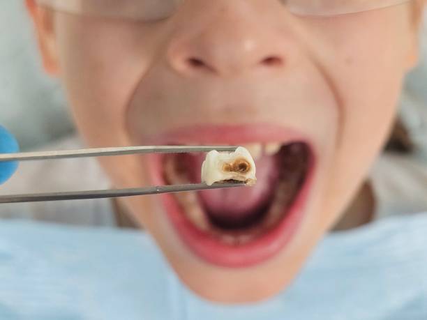 Best Urgent Dental Care for Toothache in Louisa, VA